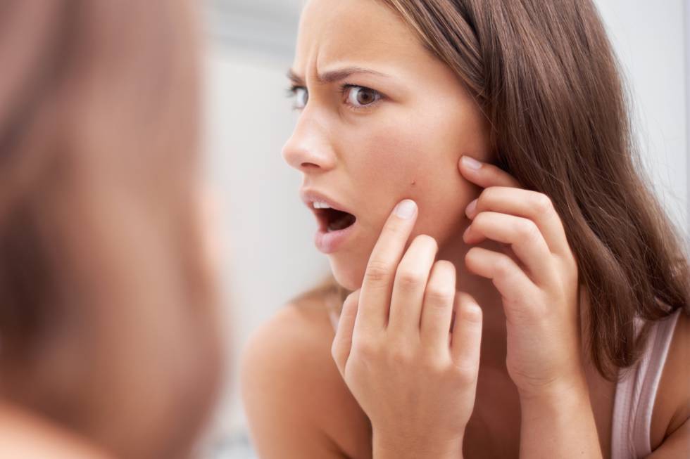 rutina facial y tratamientos acné